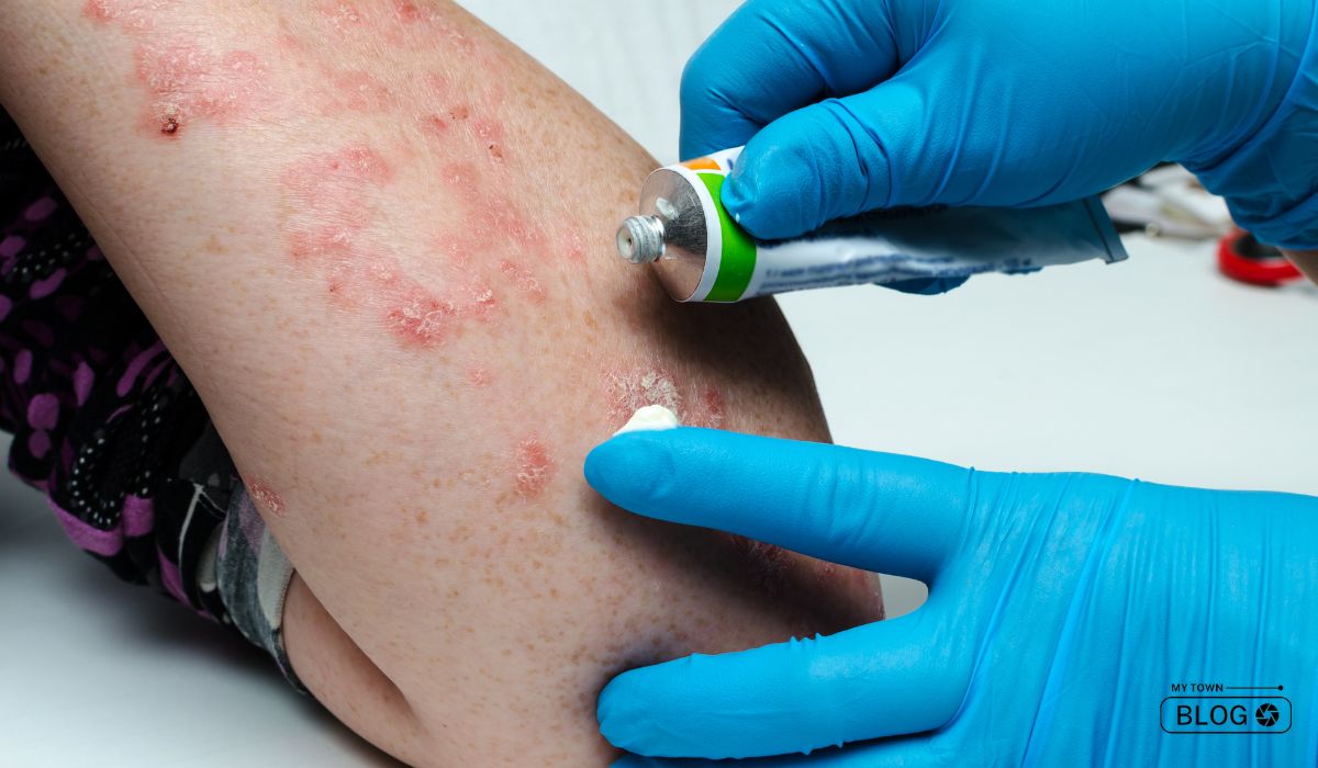 Skin Saviors: The 5 Best Dermatologists in Chandigarh