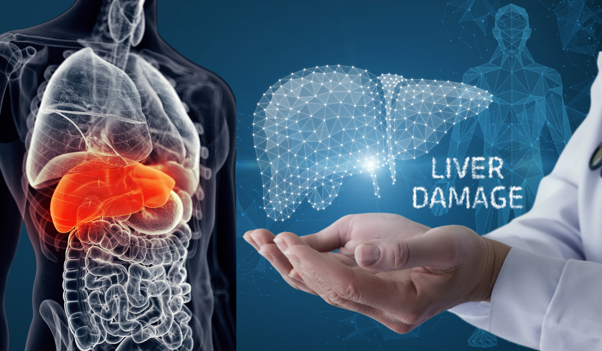 Symptoms of Liver Damage